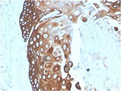 Immunohistochemistry-Paraffin: Cytokeratin 15 Antibody (SPM190) - Azide and BSA Free [NBP2-54453]