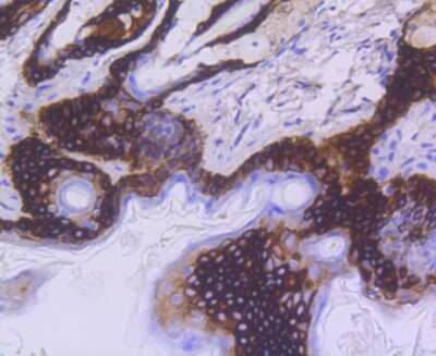 Immunohistochemistry-Paraffin: Cytokeratin 15 Antibody (ST04-85) [NBP2-67525]