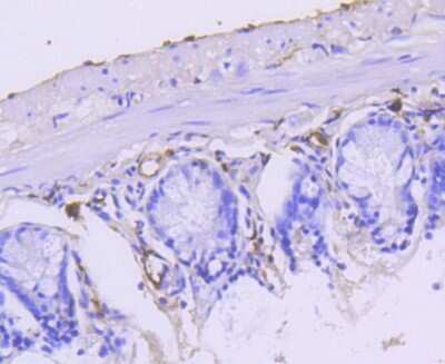 Immunohistochemistry-Paraffin: Cytokeratin 15 Antibody (ST04-85) [NBP2-67525]
