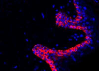 Immunohistochemistry-Paraffin: Cytokeratin 15 Antibody (ST04-85) [NBP2-67525]