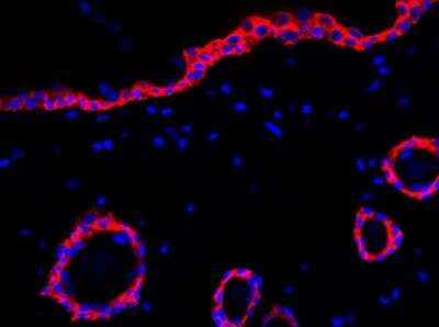 Immunohistochemistry-Paraffin: Cytokeratin 15 Antibody (ST04-85) [NBP2-67525]