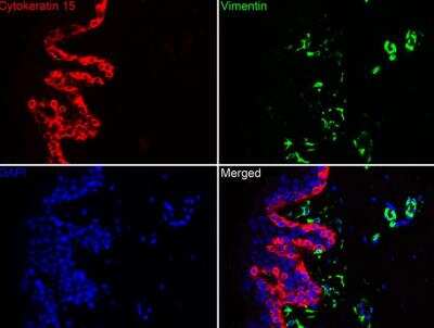 Immunohistochemistry-Paraffin: Cytokeratin 15 Antibody (ST04-85) [NBP2-67525]