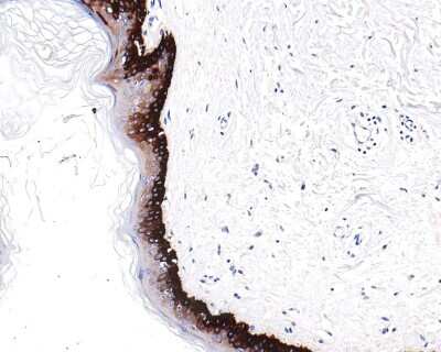 Immunohistochemistry-Paraffin: Cytokeratin 15 Antibody (ST04-85) [NBP2-67525]
