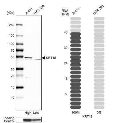 Western Blot: Cytokeratin 15 Antibody [NBP1-85602]