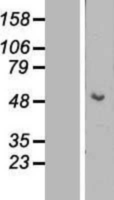 Western Blot: Cytokeratin 15 Overexpression Lysate [NBL1-12382]