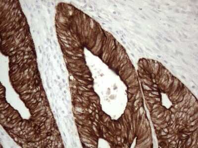 Immunohistochemistry: Cytokeratin 16 Antibody (OTI2H8) [NBP2-45538]