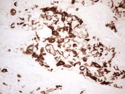 Immunohistochemistry: Cytokeratin 16 Antibody (OTI2H8) [NBP2-45538]