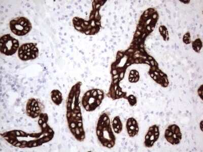 Immunohistochemistry: Cytokeratin 16 Antibody (OTI2H8) [NBP2-45538]