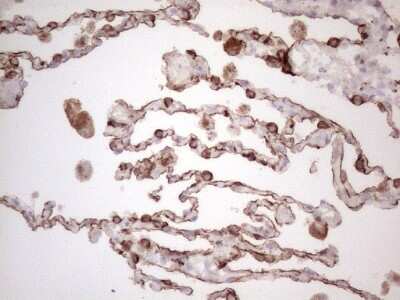 Immunohistochemistry: Cytokeratin 16 Antibody (OTI2H8) [NBP2-45538]