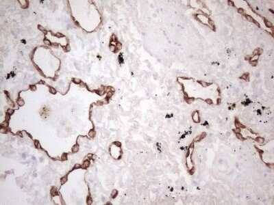 Immunohistochemistry: Cytokeratin 16 Antibody (OTI2H8) [NBP2-45538]