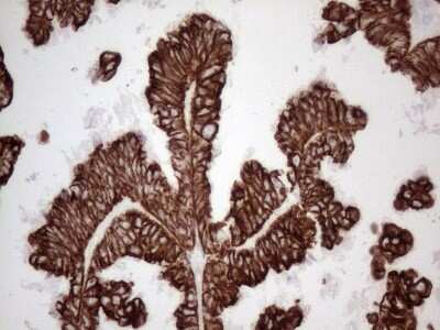 Immunohistochemistry: Cytokeratin 16 Antibody (OTI2H8) [NBP2-45538]