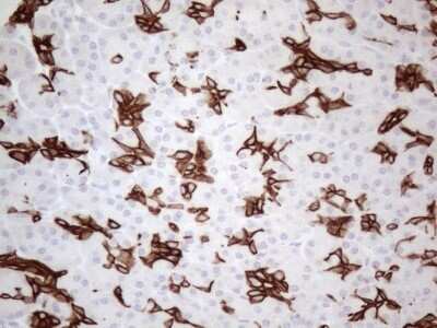 Immunohistochemistry: Cytokeratin 16 Antibody (OTI2H8) [NBP2-45538]