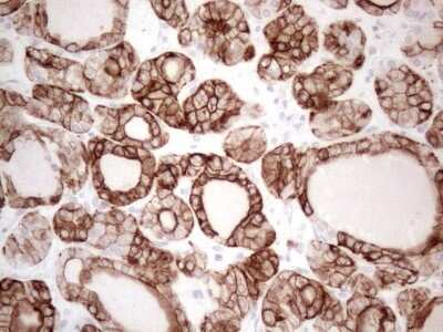Immunohistochemistry: Cytokeratin 16 Antibody (OTI2H8) [NBP2-45538]