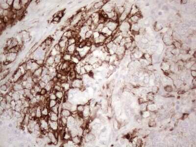 Immunohistochemistry: Cytokeratin 16 Antibody (OTI2H8) [NBP2-45538]