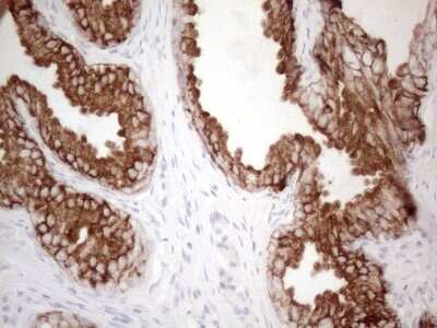 Immunohistochemistry: Cytokeratin 16 Antibody (OTI2H8) [NBP2-45538]