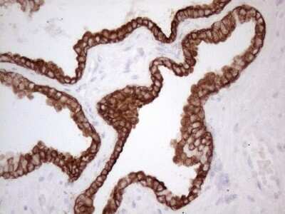 Immunohistochemistry: Cytokeratin 16 Antibody (OTI2H8) [NBP2-45538]
