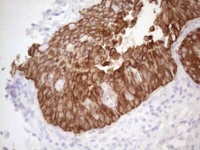 Immunohistochemistry: Cytokeratin 16 Antibody (OTI2H8) [NBP2-45538]