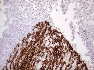 Immunohistochemistry: Cytokeratin 16 Antibody (OTI2H8) [NBP2-45538]