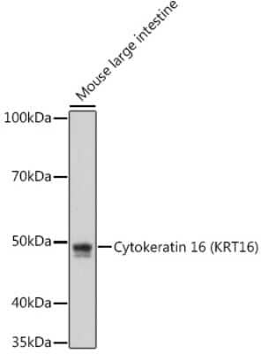 Western Blot: Cytokeratin 16 Antibody (8L6R4) [NBP3-16678]