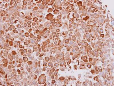 Immunohistochemistry-Paraffin: Cytokeratin 16 Antibody [NBP1-32709]
