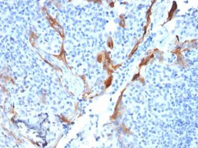 Immunohistochemistry-Paraffin: Cytokeratin 16 Antibody (KRT16/1714) - Azide and BSA Free [NBP3-08691]