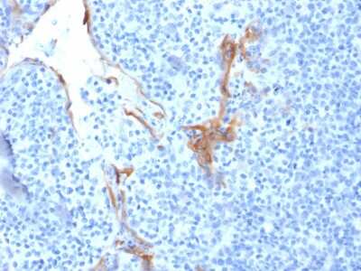 Immunohistochemistry-Paraffin: Cytokeratin 16 Antibody (LL025) - Azide and BSA Free [NBP3-08684]