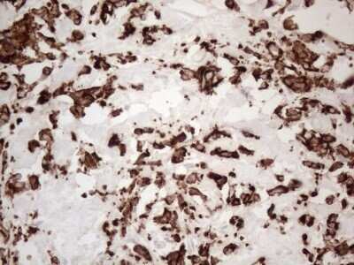 Immunohistochemistry: Cytokeratin 16 Antibody (OTI2H8) - Azide and BSA Free [NBP2-71085]