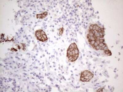 Immunohistochemistry: Cytokeratin 16 Antibody (OTI2H8) - Azide and BSA Free [NBP2-71085]