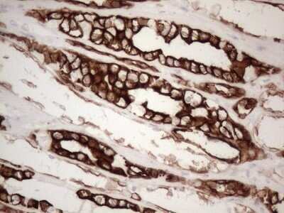 Immunohistochemistry: Cytokeratin 16 Antibody (OTI2H8) - Azide and BSA Free [NBP2-71085]