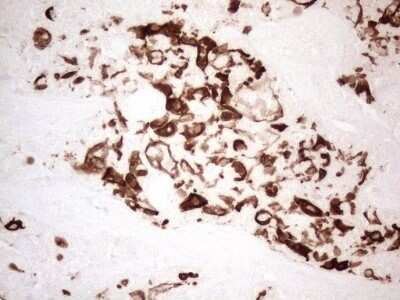 Immunohistochemistry: Cytokeratin 16 Antibody (OTI2H8) - Azide and BSA Free [NBP2-71085]