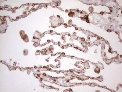 Immunohistochemistry: Cytokeratin 16 Antibody (OTI2H8) - Azide and BSA Free [NBP2-71085]