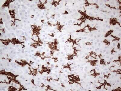 Immunohistochemistry: Cytokeratin 16 Antibody (OTI2H8) - Azide and BSA Free [NBP2-71085]