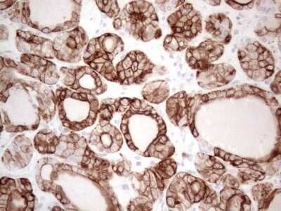 Immunohistochemistry: Cytokeratin 16 Antibody (OTI2H8) - Azide and BSA Free [NBP2-71085]