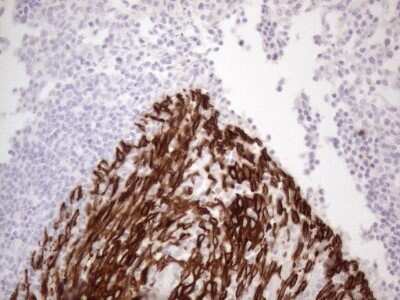 Immunohistochemistry: Cytokeratin 16 Antibody (OTI2H8) - Azide and BSA Free [NBP2-71085]