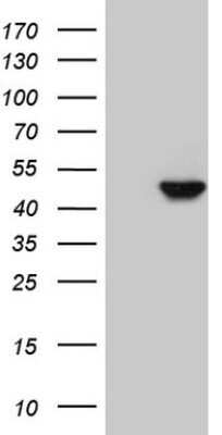 Western Blot: Cytokeratin 16 Antibody (OTI2H8)Azide and BSA Free [NBP2-71085]