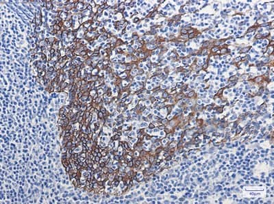 Immunohistochemistry-Paraffin: Cytokeratin 16 Antibody (S02-5F8) [NBP3-19530]