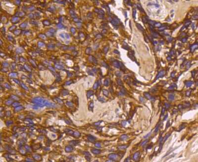 Immunohistochemistry-Paraffin: Cytokeratin 16 Antibody (SC52-09) [NBP2-67559]