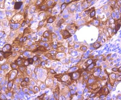 Immunohistochemistry-Paraffin: Cytokeratin 16 Antibody (SC52-09) [NBP2-67559]