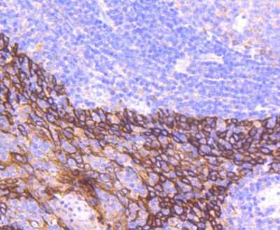 Immunohistochemistry-Paraffin: Cytokeratin 16 Antibody (SC52-09) [NBP2-67559]