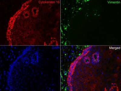 Immunohistochemistry-Paraffin: Cytokeratin 16 Antibody (SC52-09) [NBP2-67559]