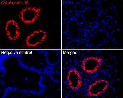 Immunohistochemistry-Paraffin: Cytokeratin 16 Antibody (SC52-09) [NBP2-67559]