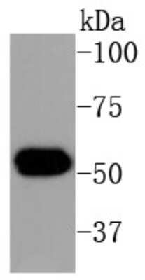 Western Blot: Cytokeratin 16 Antibody (SC52-09) [NBP2-67559]