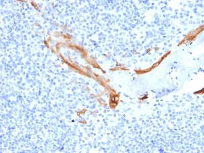 Immunohistochemistry-Paraffin: Cytokeratin 16 Antibody (SPM264) - Azide and BSA Free [NBP3-08692]