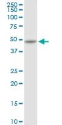 Western Blot: Cytokeratin 16 Antibody [H00003868-D01P]