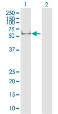 Western Blot: Cytokeratin 16 Antibody [H00003868-D01P]