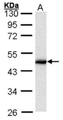 Western Blot: Cytokeratin 16 Antibody [NBP1-32709]