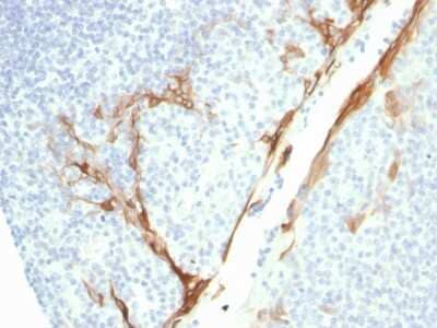 Immunohistochemistry-Paraffin: Cytokeratin 16 Antibody (rKRT16/1714) - Azide and BSA Free [NBP3-08539]