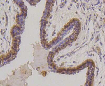 Immunohistochemistry-Paraffin: Cytokeratin 17/36 Antibody (SR45-06) [NBP2-67318]