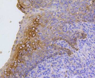 Immunohistochemistry-Paraffin: Cytokeratin 17/36 Antibody (SR45-06) [NBP2-67318]