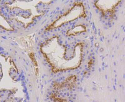 Immunohistochemistry-Paraffin: Cytokeratin 17/36 Antibody (SR45-06) [NBP2-67318]